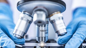 Investigadores descubren la proteína responsable de la sensación de frío