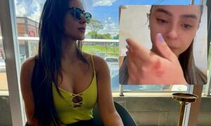 Una ex Miss fue agredida fisicamente por su ex pareja