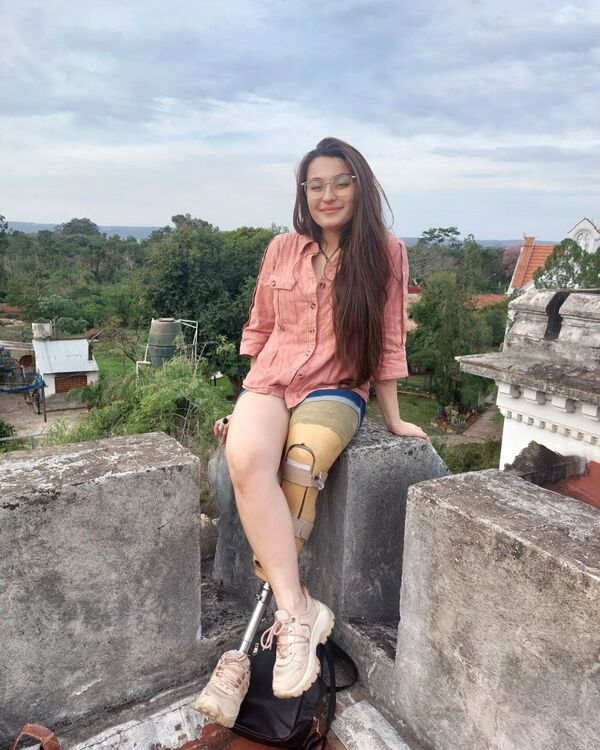 ¡Todos por Lari!: joven pide ayuda para costear prótesis que mejore su calidad de vida - trece