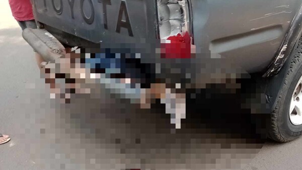 Motociclista perdió la pierna derecha al rozar por camioneta