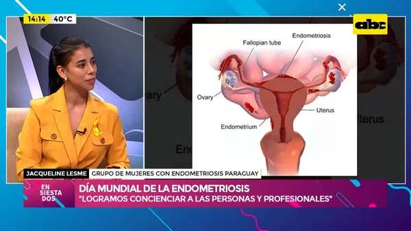 Video: Día Mundial de la Endometriosis - Ensiestados - ABC Color