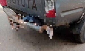 Motociclista perdió la pierna derecha al rozar por camioneta en Luque – Prensa 5