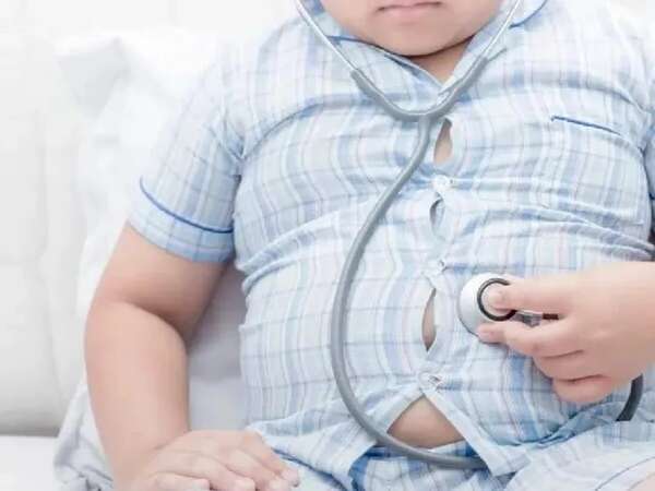 La causa principal de la obesidad sigue siendo mala alimentación y sedentarismo - Estilo de vida - ABC Color