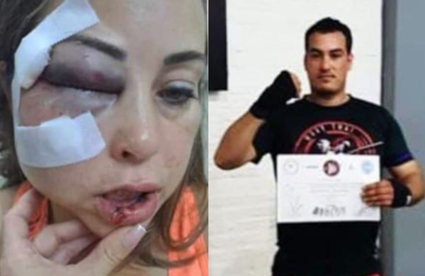 Hombre garroteó salvajemente a su expareja en Coronel Oviedo - Noticiero Paraguay