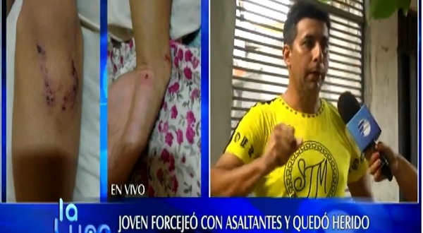 Joven resultó herido tras enfrentar a motochorros - Noticias Paraguay