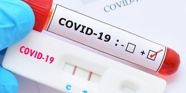 COVID-19: con leve incremento de casos en algunos departamentos