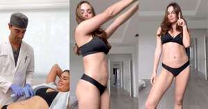 Diario HOY | Stephi Stegman se realizó tratamiento para lucir abdomen plano