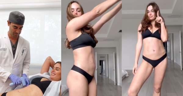 Diario HOY | Stephi Stegman se realizó tratamiento para lucir abdomen plano