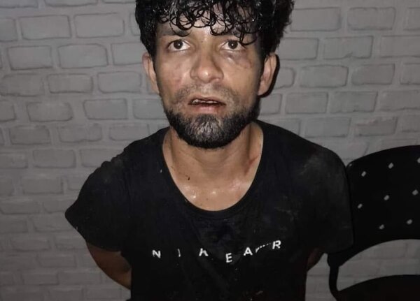 Adicto discutió con su hermana y la golpeó con un martillo en la cabeza - Radio Imperio 106.7 FM
