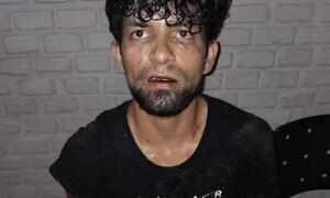 Alto Paraná: Adicto discutió con su hermana y la golpeó con un martillo en la cabeza – Prensa 5