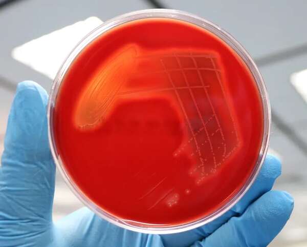 Preocupación en Japón por brote de infección vinculada a una bacteria - Ciencia - ABC Color
