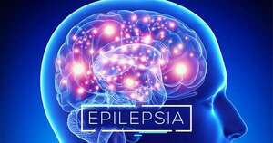 La Nación / Asociación apoya a pacientes y familiares con epilepsia