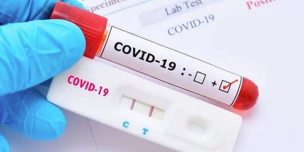 COVID-19: se reportan más de 470 casos en las últimas semanas