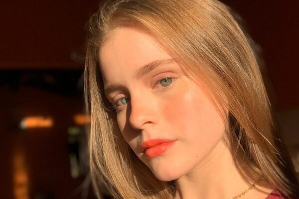 Gaby Ovelar sufrió de escaras en el rostro ¿qué le pasó?