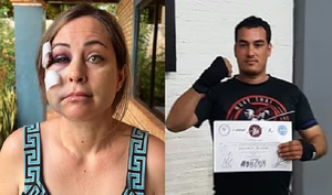 Víctima de intento de feminicidio denuncia inacción policial - Noticiero Paraguay
