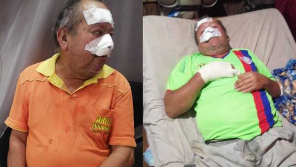 Anciano sufre brutal agresión de su hijo en Cambyretá