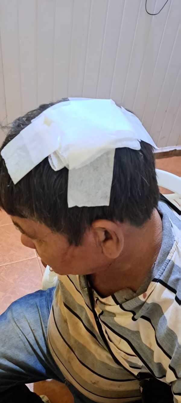 Otra agresión a pedradas en San Antonio; esta vez resultó herido un vecino