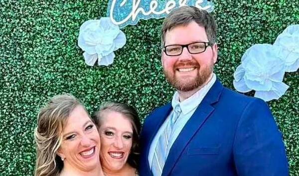 Revelan imágenes inéditas del casamiento de una de las famosas siamesas yanquis