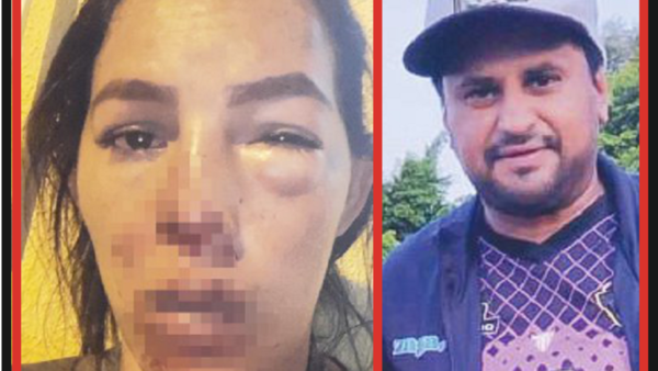 DT hizo la liga a su hija y le reventaron la cara a doña