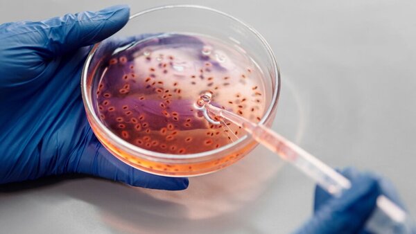 Crisis sanitaria en China: resistencia de “supergonorrea” a antibióticos preocupa a expertos - Unicanal