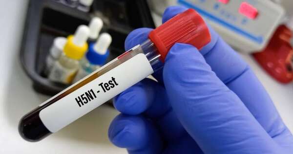 La Nación / EE. UU. detecta su primer caso humano de gripe aviar