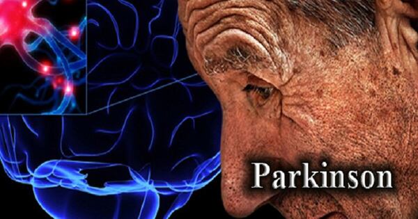 La Nación / Descubren que un medicamento contra la diabetes protege del Parkinson