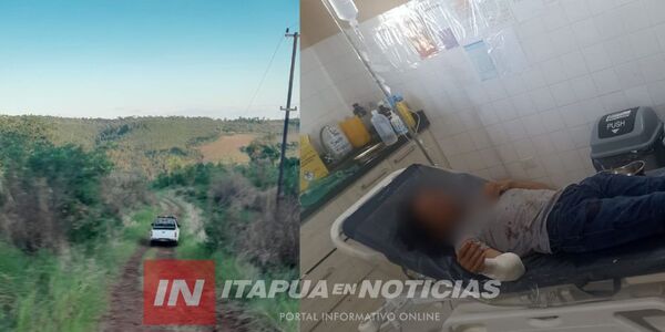 HOMBRE FUE HERIDO DE BALA EN ALTO VERÁ  - Itapúa Noticias