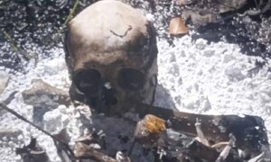Hallan cráneo y otros restos óseos de una persona en Amambay – Prensa 5