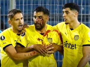 Un exfranjeado recibió piedrazo en la cara en Rosario durante un partido