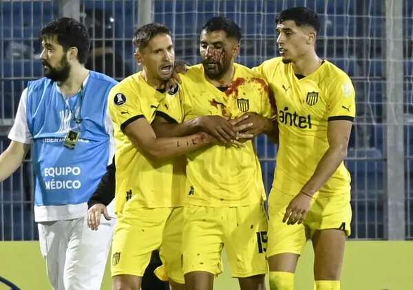 Vídeo: Un ex Olimpia recibió un piedrazo en la cara en Rosario - Fútbol Internacional - ABC Color