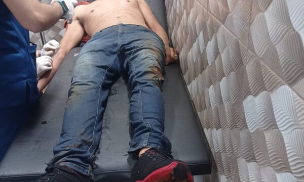 Hieren con cascote a hombre en Hernandarias