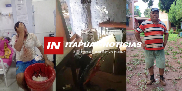 HOMBRE DENUNCIÓ AGRESIÓN, ATROPELLO POLICIAL Y ROBO EN SU VIVIENDA DE ENCARNACIÓN - Itapúa Noticias