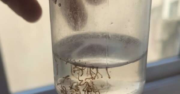 La Nación / Argentina registra 161 fallecidos por dengue