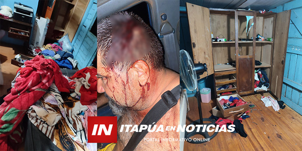 GOLPEARON BRUTALMENTE A UN HOMBRE PARA ROBARLE EN ENCARNACIÓN - Itapúa Noticias