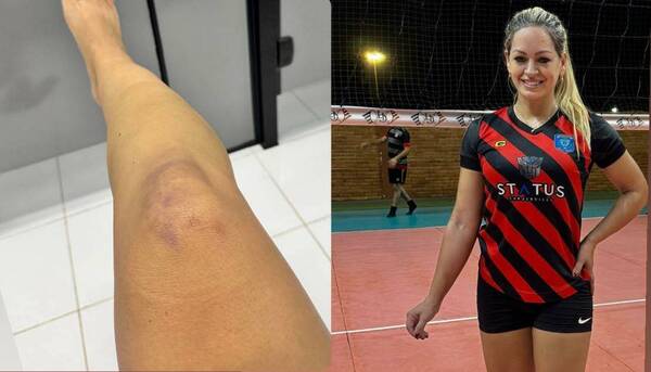 Ex-modelo terminó en el hospital después de un partido de vóley