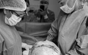 IPS: retiran gigantesco tumor de 9 kilos del ovario de una mujer - trece
