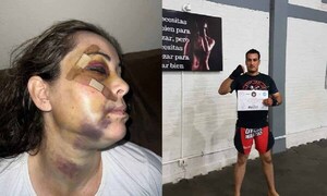 Coronel Oviedo: Hombre que agredió a su expareja sigue prófugo a un mes de brutal agresión – Prensa 5