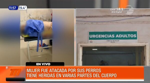 Fue atacada por sus propios perros y está grave | Telefuturo