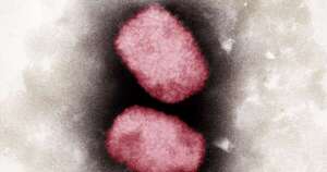 Diario HOY | Descubren nueva cepa mutante “potencialmente pandémica” de viruela del mono