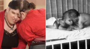 Murieron a los 62 años los siameses más longevos del mundo: nunca habían querido separarse