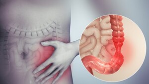 Descubren conexión entre el síndrome de intestino irritable y el sistema cardiovascular