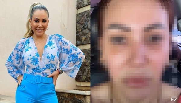 Ruth reveló fotos del cuadro depresivo que atravesó - Teleshow