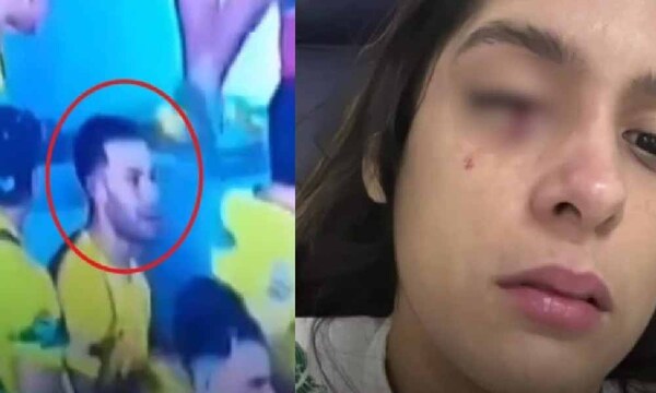 Identifican a joven que habría herido a una mujer con hondita en Coronel Oviedo – Prensa 5