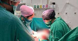 Diario HOY | Extraen tumor de 23 kilos de paciente de 43 años en el hospital de Concepción