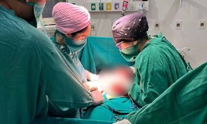 Extraen tumor de 23 kilos de paciente de 43 años en el hospital de Concepción – Prensa 5