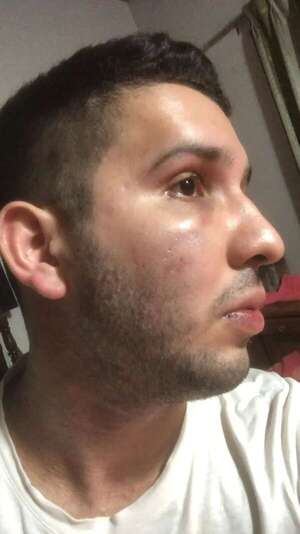 Padre denuncia brutal agresión a su hijo a la salida de discoteca - Policiales - ABC Color