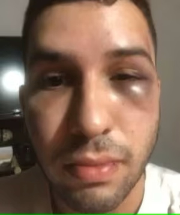 Joven es brutalmente agredido tras salir de un bar - La Tribuna