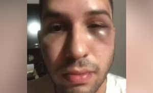 Joven fue brutalmente agredido tras salir de una discoteca en Asunción - Noticiero Paraguay