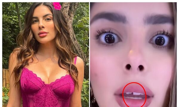 (VIDEO)¡Esta exMiss perdió un diente!