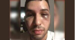 "Me atacaron entre 6 hombres": habló el joven que ligó brutal golpiza a la salida de una discoteca